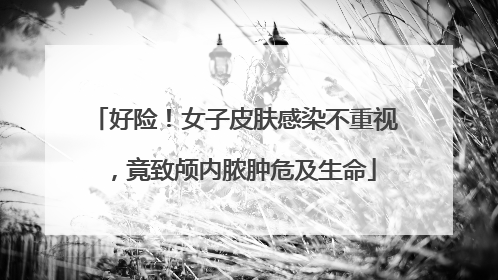 好险！女子皮肤感染不重视，竟致颅内脓肿危及生命
